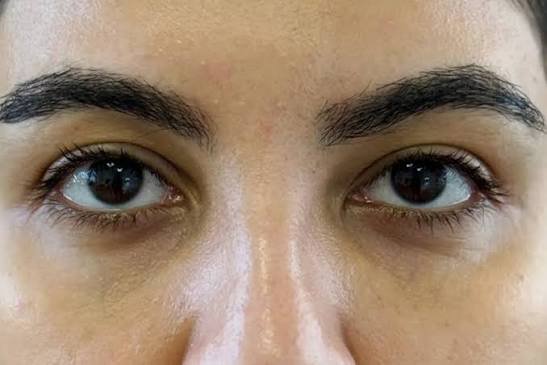 Refreshed Eyes